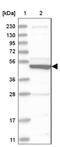 Solute Carrier Family 10 Member 3 antibody, NBP1-84957, Novus Biologicals, Western Blot image 