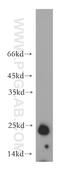 Heat shock protein beta-1 antibody, 21755-1-AP, Proteintech Group, Western Blot image 