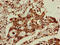UPF0405 protein C3orf75 antibody, LS-C677812, Lifespan Biosciences, Immunohistochemistry paraffin image 