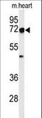 DNA Cross-Link Repair 1C antibody, LS-B9422, Lifespan Biosciences, Western Blot image 