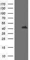Mitogen-Activated Protein Kinase Kinase 1 antibody, CF505705, Origene, Western Blot image 