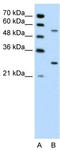 3-Phosphoinositide Dependent Protein Kinase 1 antibody, TA329143, Origene, Western Blot image 