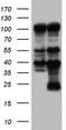 Poly(ADP-Ribose) Polymerase 1 antibody, TA804938S, Origene, Western Blot image 