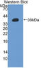 Metallothionein 2A antibody, LS-C314847, Lifespan Biosciences, Western Blot image 