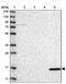 Vesicle Associated Membrane Protein 5 antibody, PA5-57148, Invitrogen Antibodies, Western Blot image 