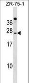 Immunoglobulin superfamily member 6 antibody, LS-C159894, Lifespan Biosciences, Western Blot image 