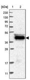 Carnosine N-Methyltransferase 1 antibody, PA5-55408, Invitrogen Antibodies, Western Blot image 