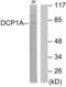 Decapping MRNA 1A antibody, LS-C119277, Lifespan Biosciences, Western Blot image 