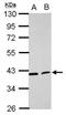 Acyl-CoA Dehydrogenase Long Chain antibody, NBP2-15235, Novus Biologicals, Western Blot image 