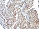 Estrogen Receptor 2 antibody, V2494IHC-7ML, NSJ Bioreagents, Immunohistochemistry frozen image 