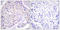 Alpha-PAK antibody, LS-C199399, Lifespan Biosciences, Immunohistochemistry paraffin image 