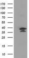 V-Set And Immunoglobulin Domain Containing 2 antibody, TA502161, Origene, Western Blot image 