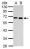 Hyaluronan Synthase 3 antibody, PA5-30056, Invitrogen Antibodies, Western Blot image 