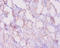 BCL2 antibody, A52548-100, Epigentek, Immunohistochemistry paraffin image 