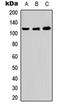 ADAM Metallopeptidase With Thrombospondin Type 1 Motif 10 antibody, orb234997, Biorbyt, Western Blot image 