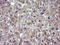 HSD17B4 antibody, LS-C788441, Lifespan Biosciences, Immunohistochemistry paraffin image 