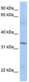 Mitochondrial Ribosomal Protein L19 antibody, TA339311, Origene, Western Blot image 