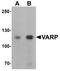 Ankyrin Repeat Domain 27 antibody, A08157-1, Boster Biological Technology, Western Blot image 