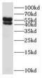 Solute Carrier Family 18 Member A1 antibody, FNab07914, FineTest, Western Blot image 
