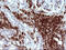 Intercellular Adhesion Molecule 3 antibody, M03651-2, Boster Biological Technology, Immunohistochemistry paraffin image 