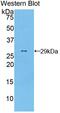 Torsin 1A Interacting Protein 2 antibody, MBS2001671, MyBioSource, Western Blot image 
