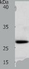 Retinoic Acid Receptor Responder 1 antibody, TA322933, Origene, Western Blot image 