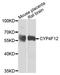 Cytochrome P450 Family 4 Subfamily F Member 12 antibody, PA5-76497, Invitrogen Antibodies, Western Blot image 