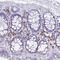 Farnesyltransferase, CAAX Box, Beta antibody, HPA062743, Atlas Antibodies, Immunohistochemistry paraffin image 