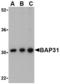 B Cell Receptor Associated Protein 31 antibody, TA306278, Origene, Western Blot image 