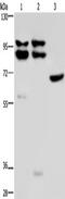 OS9 Endoplasmic Reticulum Lectin antibody, TA350253, Origene, Western Blot image 