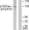 BCAR1 Scaffold Protein, Cas Family Member antibody, TA312725, Origene, Western Blot image 