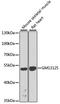 Gm13125 antibody, A8095, ABclonal Technology, Western Blot image 