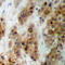 Cytidine/Uridine Monophosphate Kinase 1 antibody, LS-C358946, Lifespan Biosciences, Immunohistochemistry paraffin image 