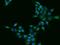 Cathepsin Z antibody, 201244-T02, Sino Biological, Immunohistochemistry paraffin image 