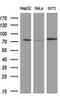 ATK antibody, GTX84785, GeneTex, Western Blot image 