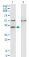 Centromere Protein V antibody, H00201161-M05, Novus Biologicals, Western Blot image 