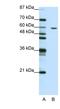 Zinc finger protein 382 antibody, NBP1-80380, Novus Biologicals, Western Blot image 