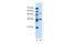 Transmembrane Protein 8B antibody, 29-667, ProSci, Western Blot image 
