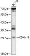Cyclin-dependent kinase inhibitor 1B antibody, 15-105, ProSci, Western Blot image 