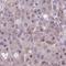 Radial Spoke Head 10 Homolog B antibody, HPA049182, Atlas Antibodies, Immunohistochemistry paraffin image 
