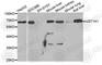 UDP Glucuronosyltransferase Family 1 Member A1 antibody, A6186, ABclonal Technology, Western Blot image 