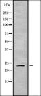 Cation Channel Sperm Associated Auxiliary Subunit Beta antibody, orb338148, Biorbyt, Western Blot image 