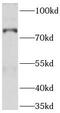 Ald antibody, FNab00037, FineTest, Western Blot image 