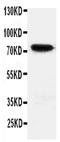 HIF3-alpha-1 antibody, PA5-79362, Invitrogen Antibodies, Western Blot image 