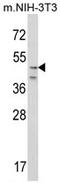 Corticotropin Releasing Hormone Receptor 2 antibody, AP17245PU-N, Origene, Western Blot image 