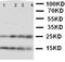 Nucleoplasmin-2 antibody, LS-C313122, Lifespan Biosciences, Western Blot image 