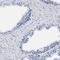 Zinc finger protein ZFAT antibody, HPA020989, Atlas Antibodies, Immunohistochemistry paraffin image 