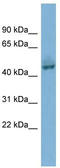 Pygopus homolog 1 antibody, TA339721, Origene, Western Blot image 
