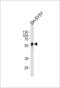 Abhydrolase Domain Containing 3 antibody, 57-300, ProSci, Western Blot image 
