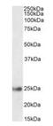 Glutathione S-Transferase Alpha 4 antibody, orb382934, Biorbyt, Western Blot image 